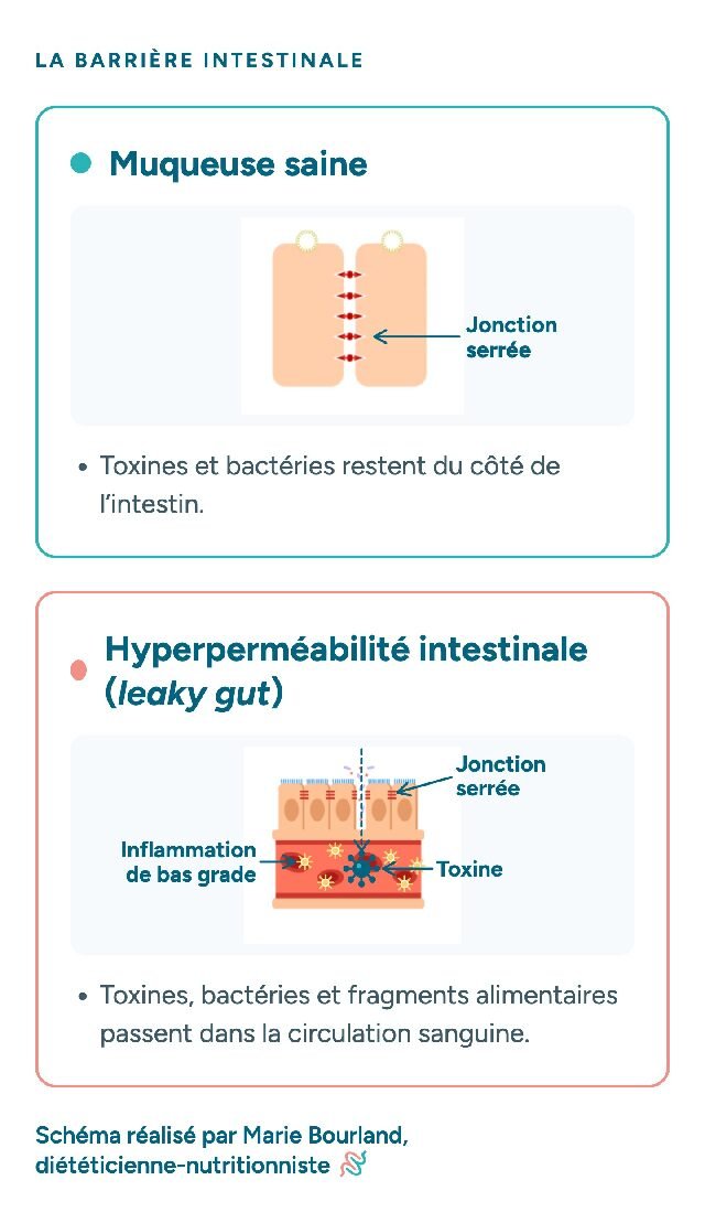 Schéma de la barrière intestinale : muqueuse saine et hyperperméabilité