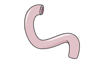 Intestin grêle